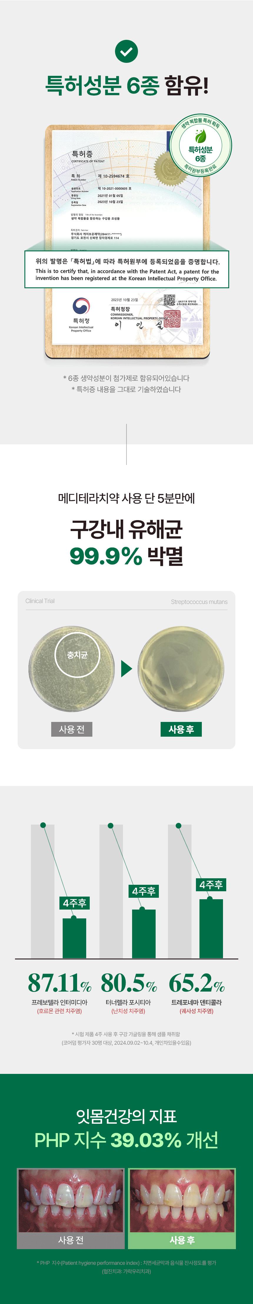 상세_메디테라_잇몸_250411_1_3.jpg