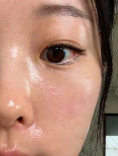 다들 보니까 추어져서 요철 올라올 시즌 맞나봄 ㅋㅋㅋ 나도 그랬는뎈ㅋㅋ 방법 알려줌!(+전후사진 이씀)