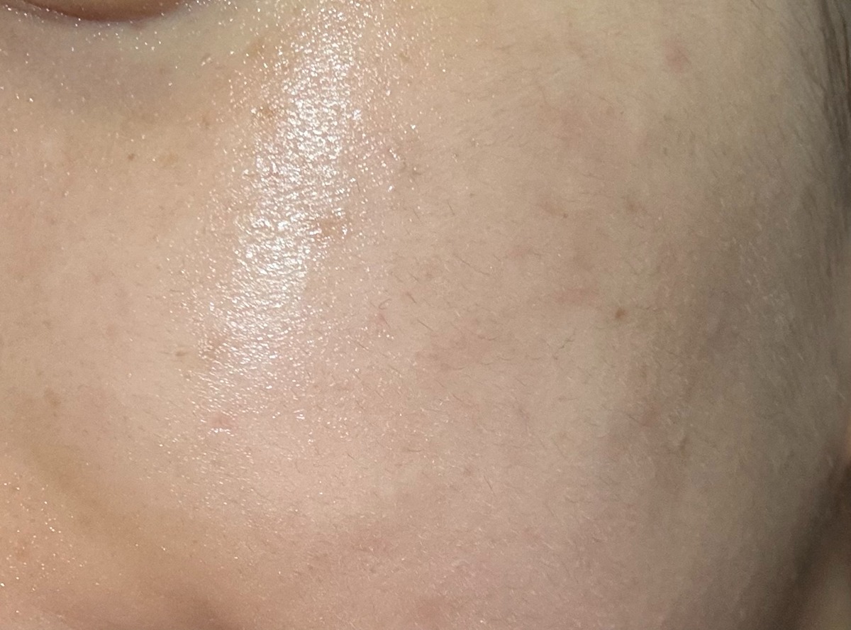 아토피+수부지 피부 기초템 후기 (8)