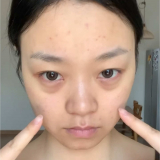 와 이 사람 눈밑꺼짐 커버 대박 잘해