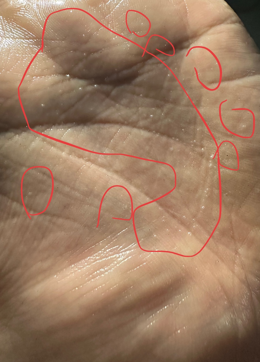 모공 블랙헤드+피지+파데 끼임 때매 저숭라라 간 톨을 위한 트위터 오일밤 ㅊㅊ(세미혐주의)