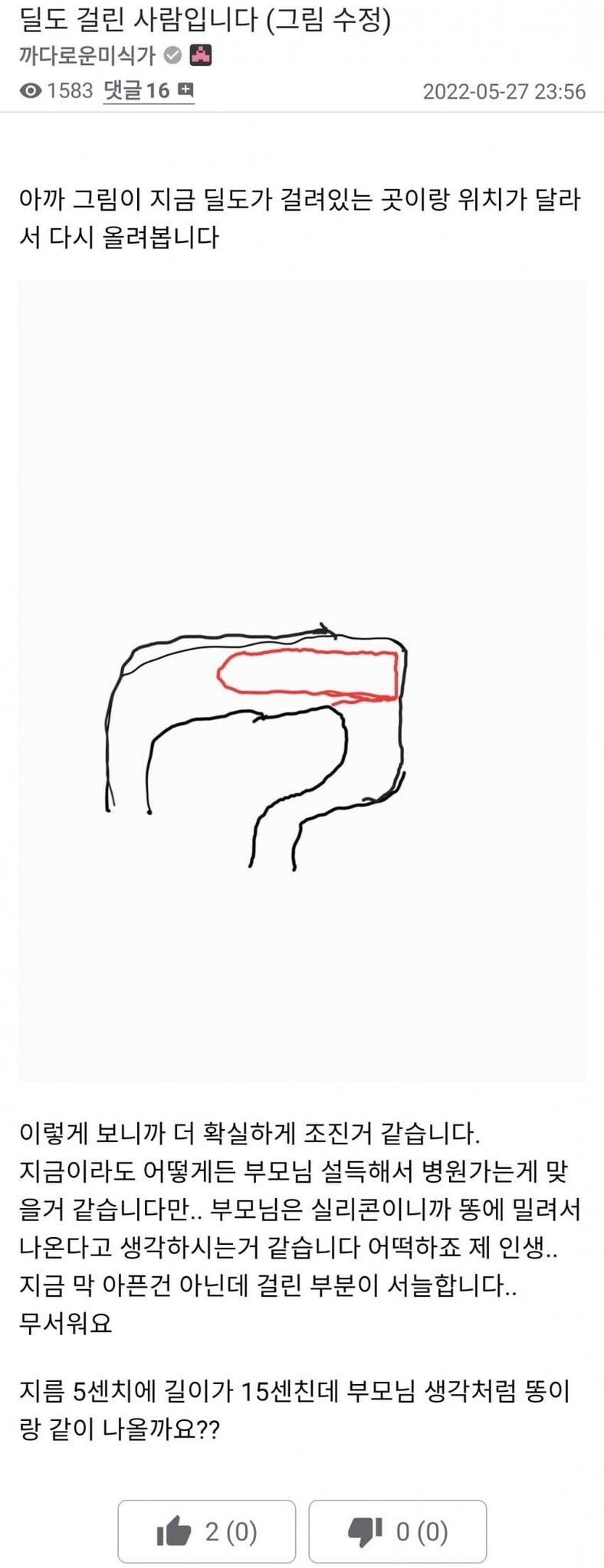 고오급 딜도에 ㅂㄹ이 달려있는 이유