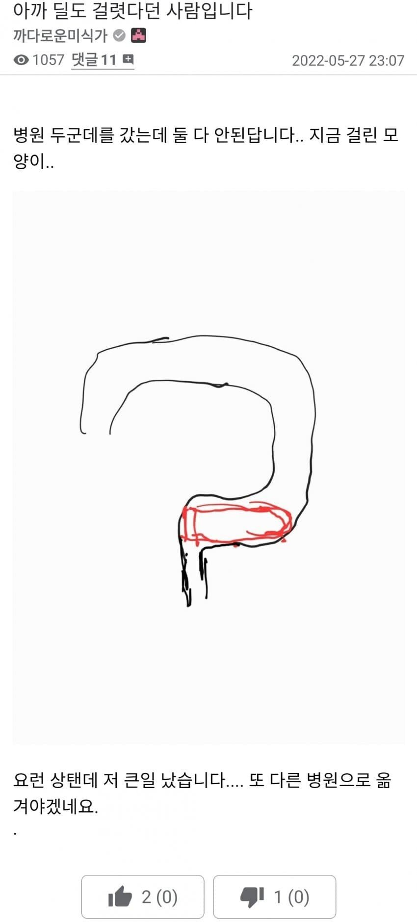 고오급 딜도에 ㅂㄹ이 달려있는 이유