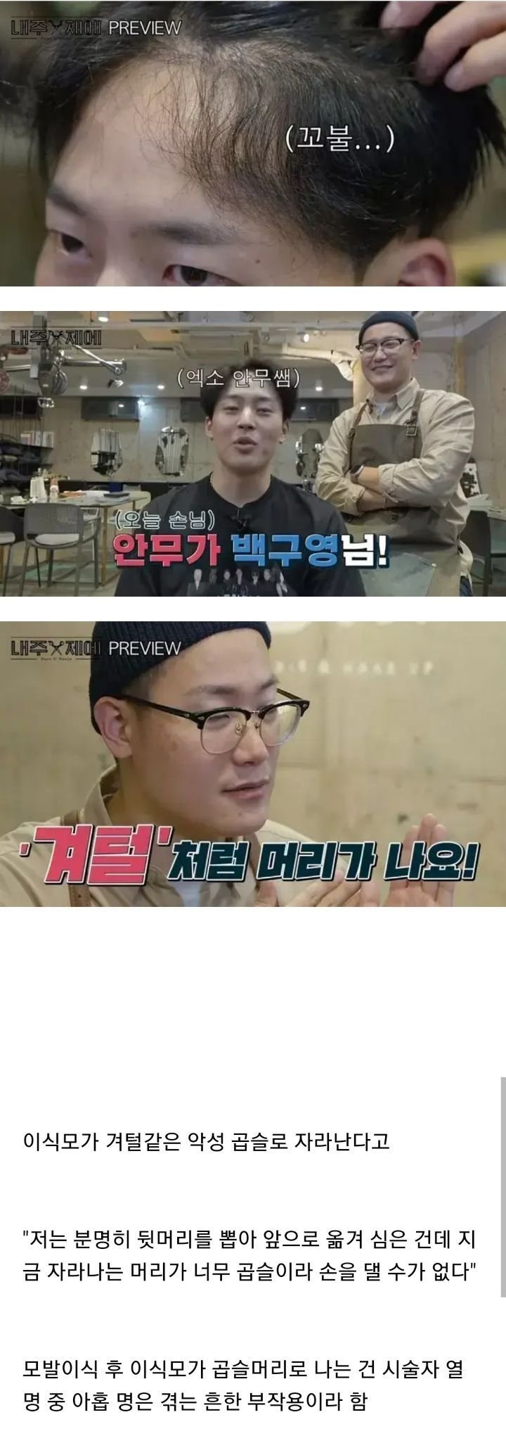 모발이식수술 부작용.jpg