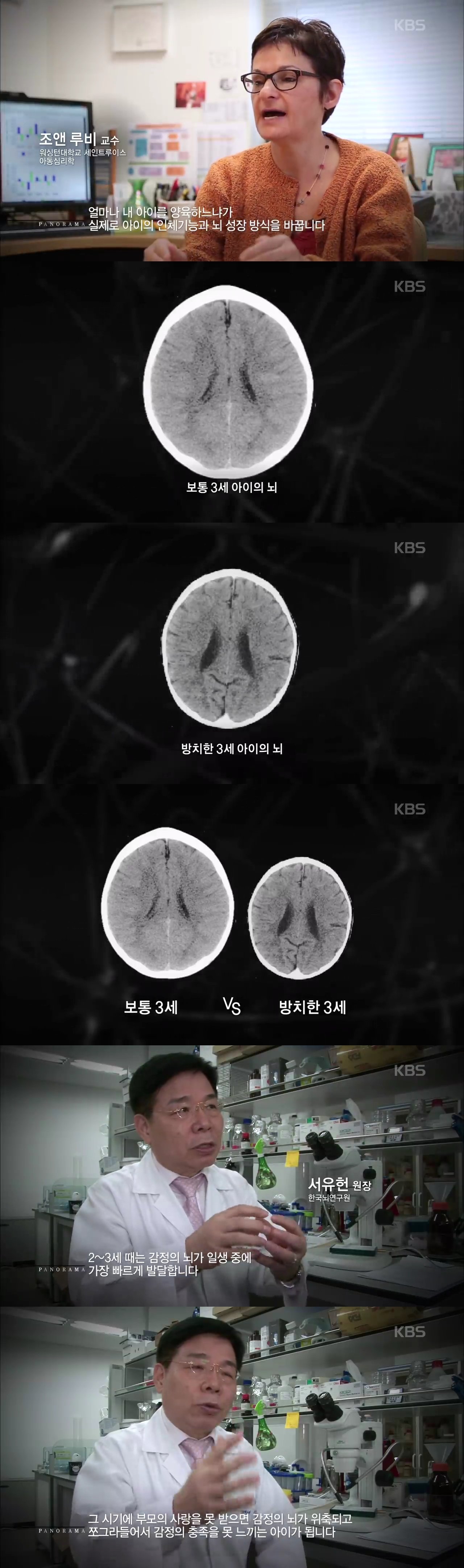 성인 뇌의 80_까지 성장하는 영유아기.jpg