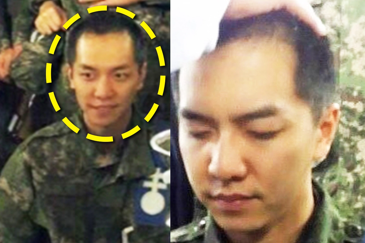 어쩐지 승기 헤어라인 부자연스럽더라니