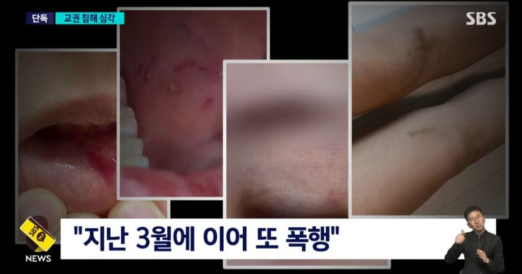 애들이 보는 앞에서 학생한테 폭행당한 초등 여교사 jpg | 인스티즈