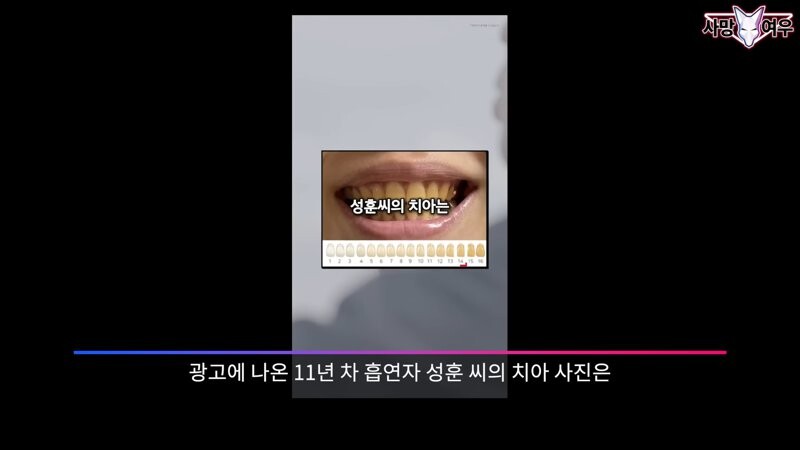 img/23/11/11/18bb9c348639f1ad.png 미백 치약 허위 광고 고발한 사망여우 근황.JPG
