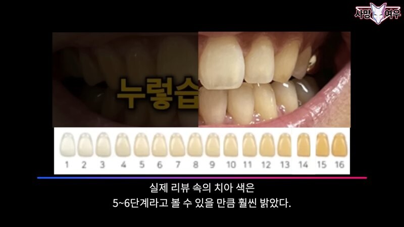 img/23/11/11/18bb9c348d69f1ad.png 미백 치약 허위 광고 고발한 사망여우 근황.JPG