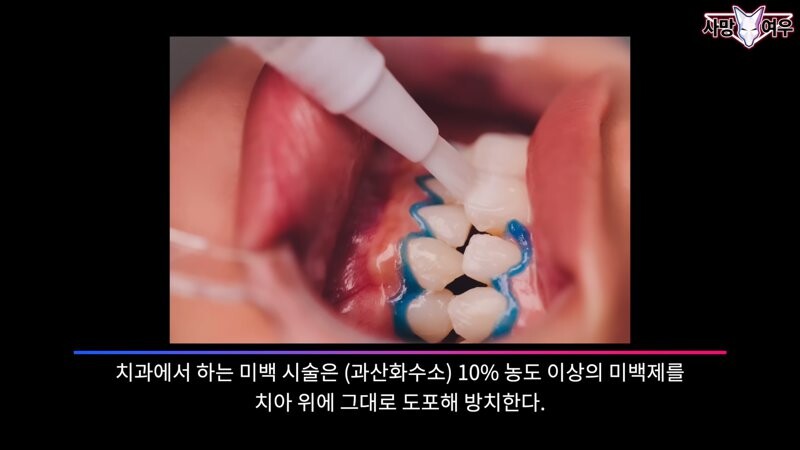 img/23/11/11/18bb9c381769f1ad.png 미백 치약 허위 광고 고발한 사망여우 근황.JPG