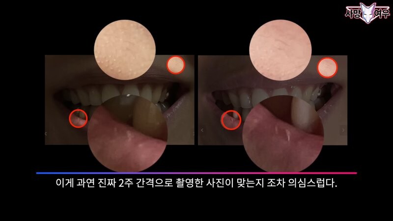 img/23/11/11/18bb9c34ce69f1ad.png 미백 치약 허위 광고 고발한 사망여우 근황.JPG