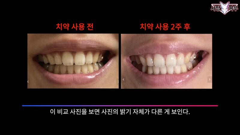 img/23/11/11/18bb9c34ed89f1ad.png 미백 치약 허위 광고 고발한 사망여우 근황.JPG