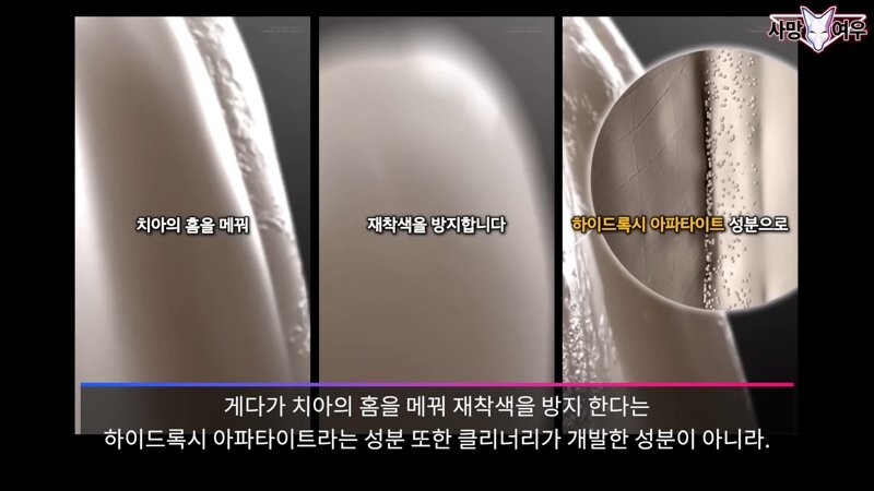 img/23/11/11/18bb9c37f129f1ad.png 미백 치약 허위 광고 고발한 사망여우 근황.JPG