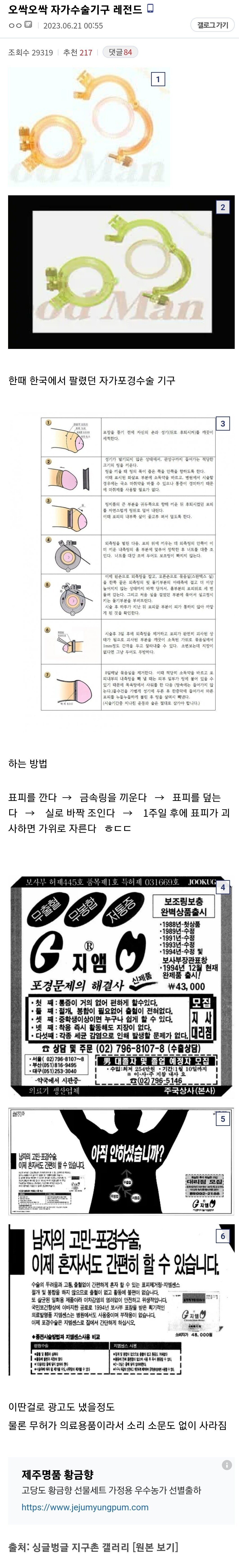 Screenshot_20230621_014427_Chrome.jpg 약혐, ㅎㅂ) 자가 수술 성인용품 기구 레전드....jpg