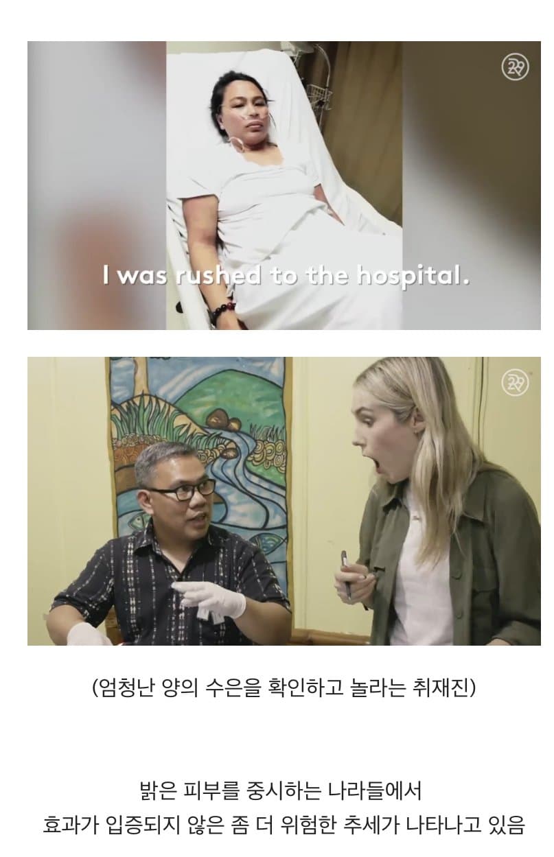 BBC 하얀피부 집착_6.jpg
