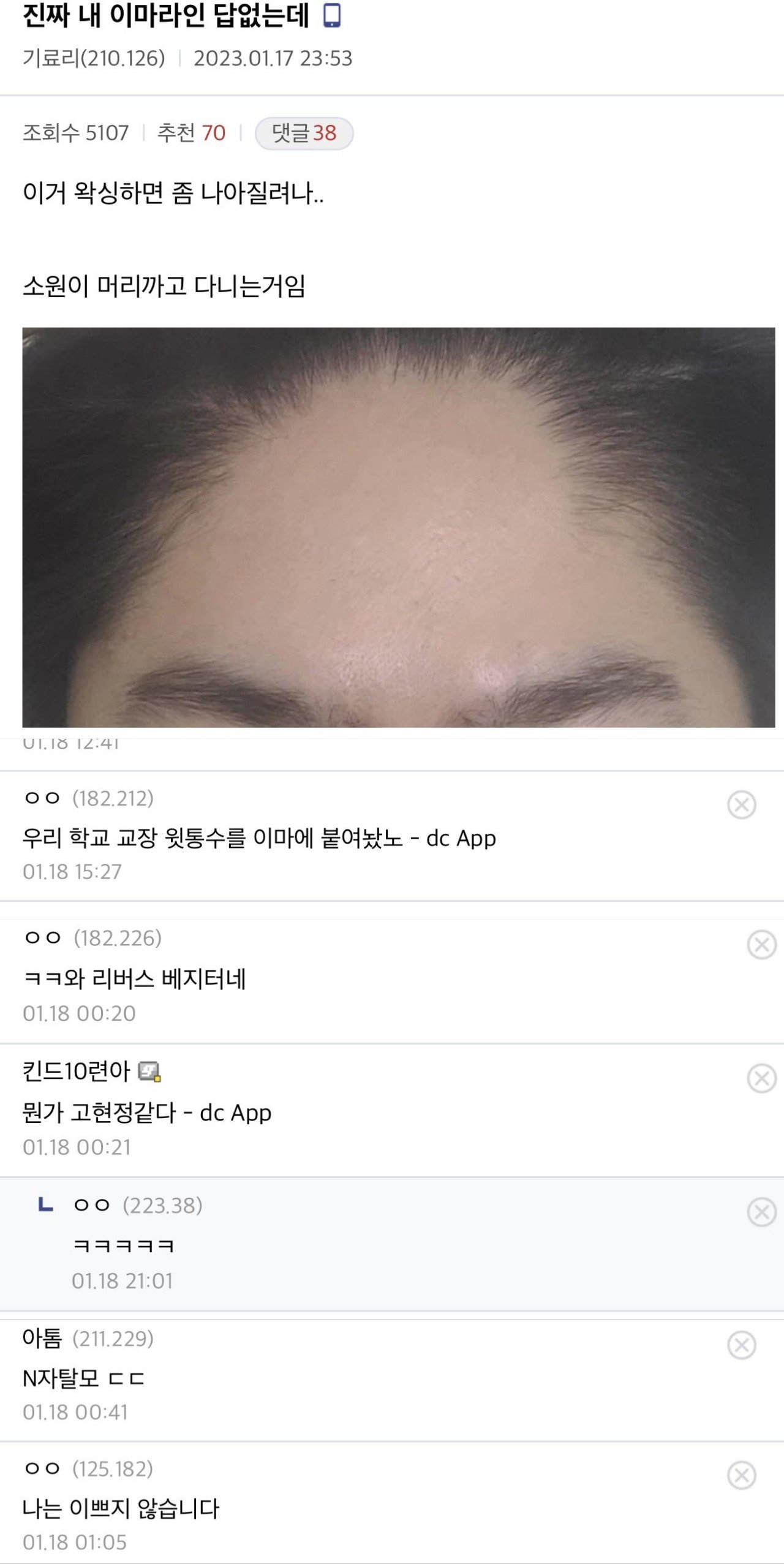 Zombodroid_30032023124727.jpg 디시 헤어갤 레전드 글 모음.jpg