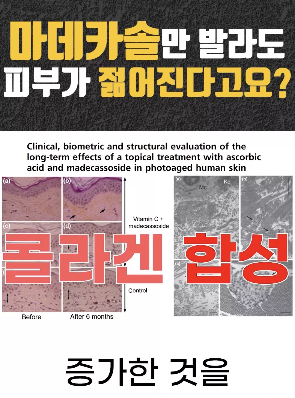 의사 피셜 ‘이거’ 바르면 피부가 젊어진다는 사실.jpg 8번째 사진