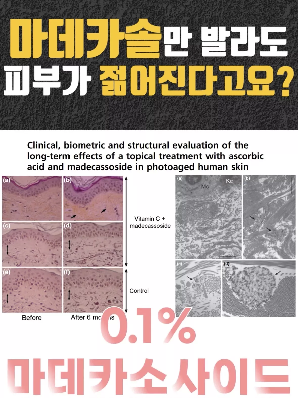 의사 피셜 ‘이거’ 바르면 피부가 젊어진다는 사실.jpg 7번째 사진