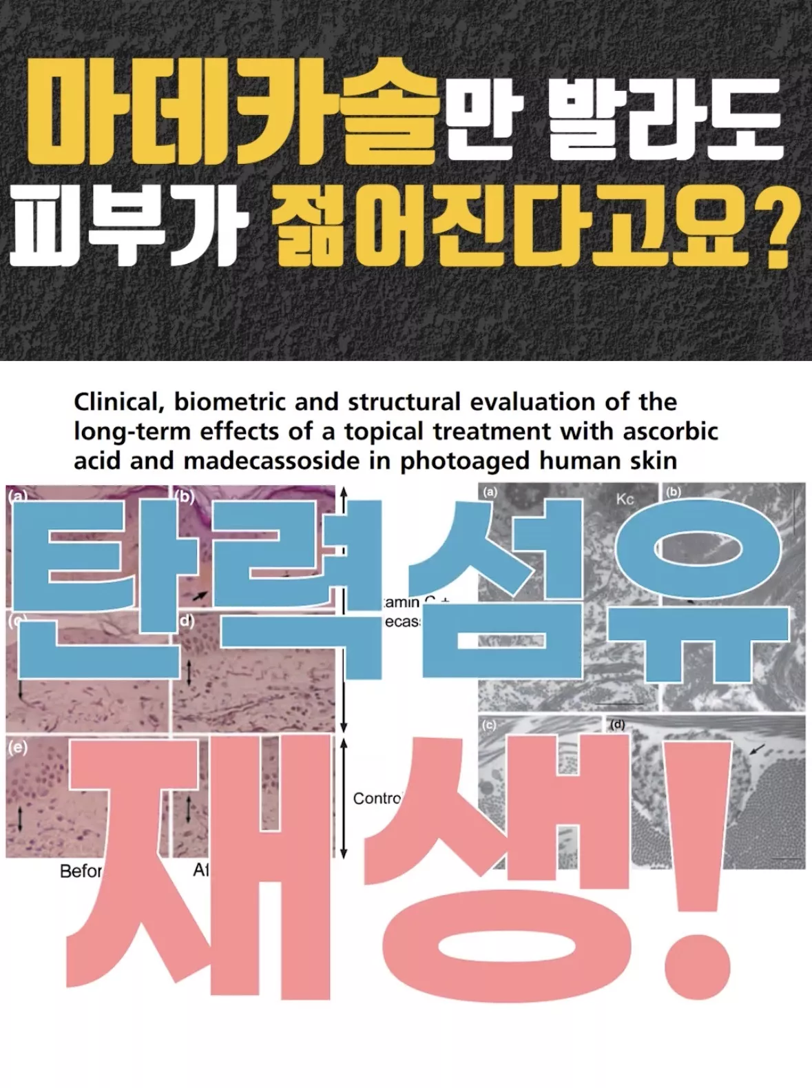 의사 피셜 ‘이거’ 바르면 피부가 젊어진다는 사실.jpg 9번째 사진