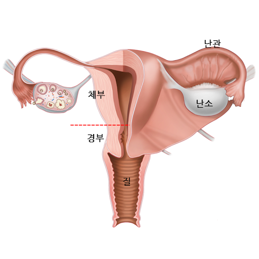 176559ed84e4fb8cc.png 자궁까지 삽입이 안 되는 이유...jpg