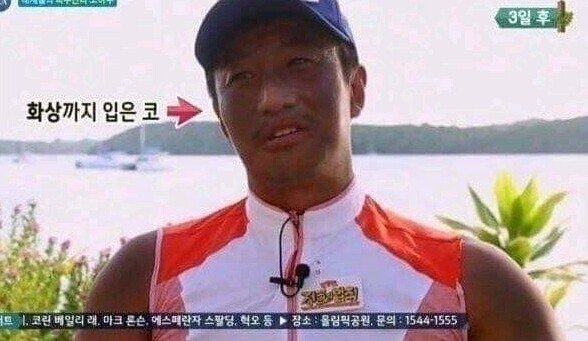 정글에서 썬크림 안바르면 생기는 일....jpg