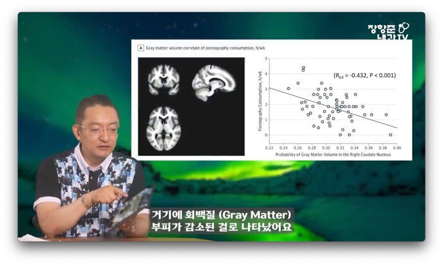 야동 시청시간에 비례해서 뇌가 쪼그라든다는 연구 결과.jpg (5).jpg
