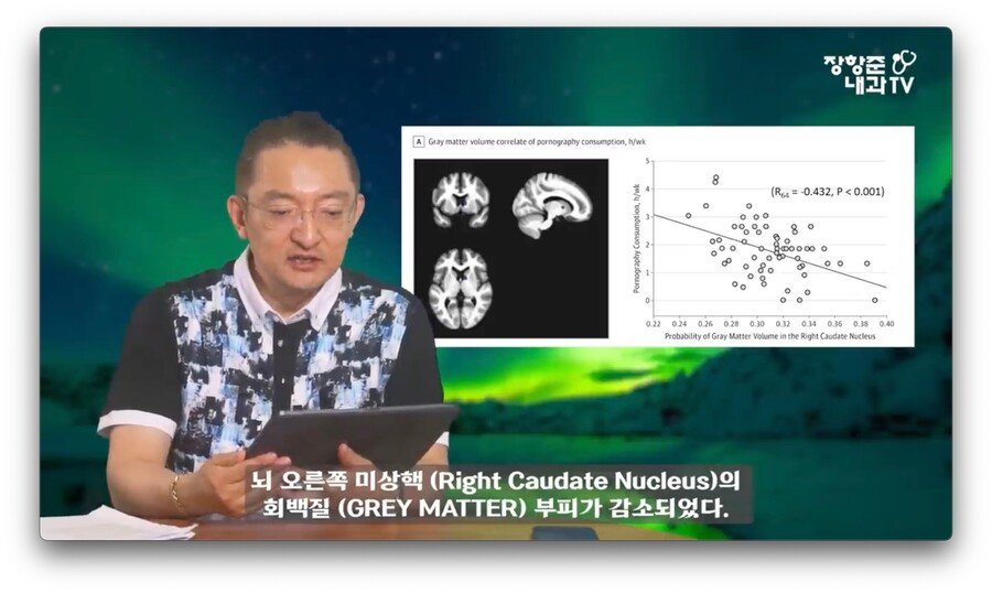 야동 시청시간에 비례해서 뇌가 쪼그라든다는 연구 결과.jpg.jpg