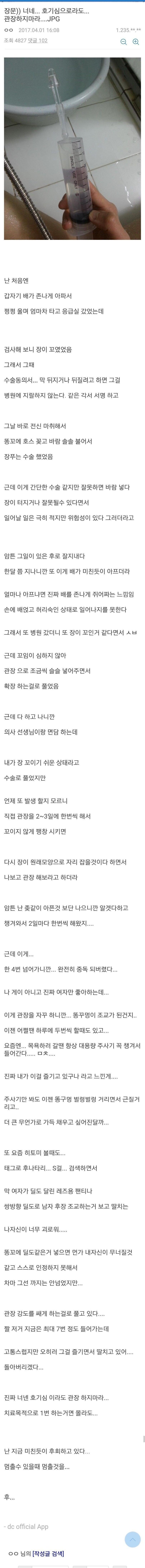 IMG_4896.jpeg 장문)) 너네... 호기심으로라도... 관장하지마라...