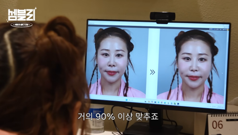 서준맘 박세미가 앞트임 복원 수술 없이도 미간 넓어질 수 있는 방법 | 인스티즈