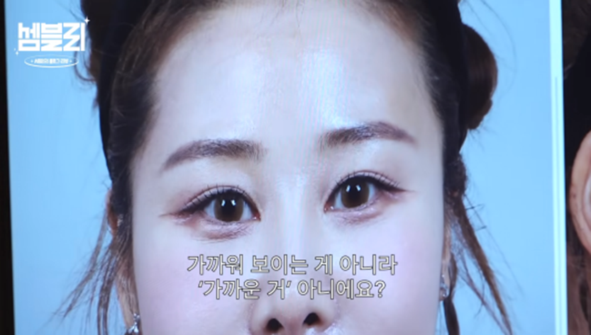 서준맘 박세미가 앞트임 복원 수술 없이도 미간 넓어질 수 있는 방법 | 인스티즈