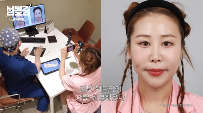 서준맘 박세미가 앞트임 복원 수술 없이도 미간 넓어질 수 있는 방법 | 인스티즈