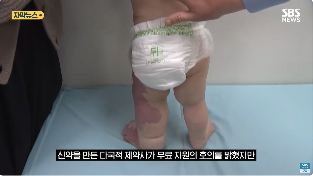 7.png "와 이건 가만히 못 있겠네" 의사와 부모가 기적을 썼다