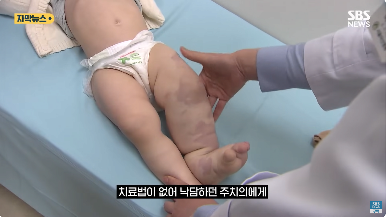 2.png "와 이건 가만히 못 있겠네" 의사와 부모가 기적을 썼다