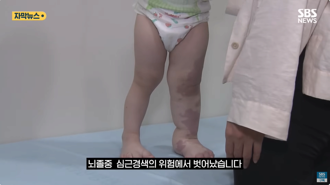 23.png "와 이건 가만히 못 있겠네" 의사와 부모가 기적을 썼다