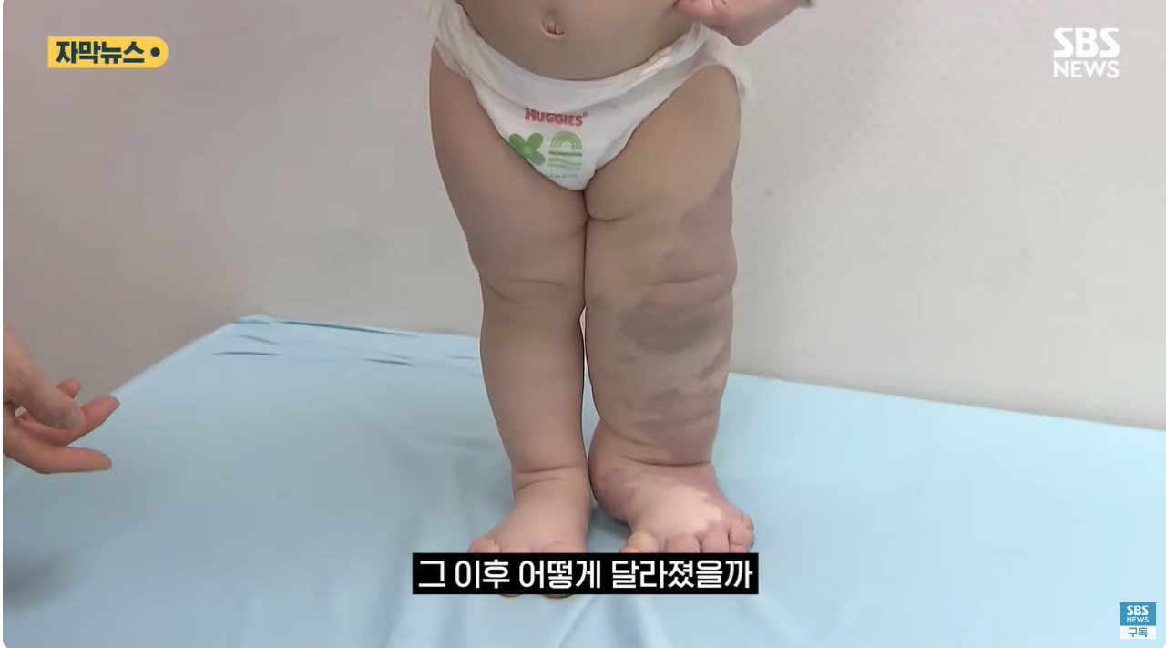 15.png "와 이건 가만히 못 있겠네" 의사와 부모가 기적을 썼다