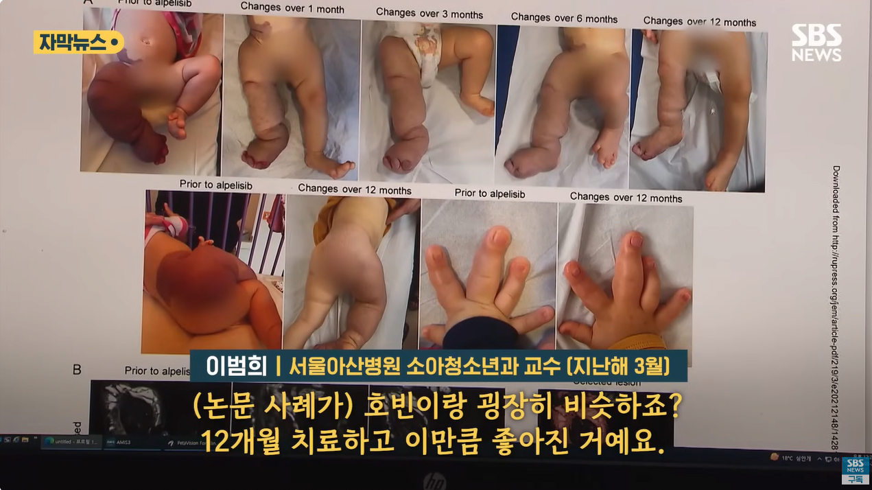 5.png "와 이건 가만히 못 있겠네" 의사와 부모가 기적을 썼다