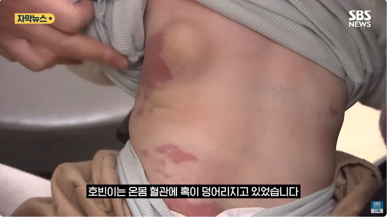 1.png "와 이건 가만히 못 있겠네" 의사와 부모가 기적을 썼다