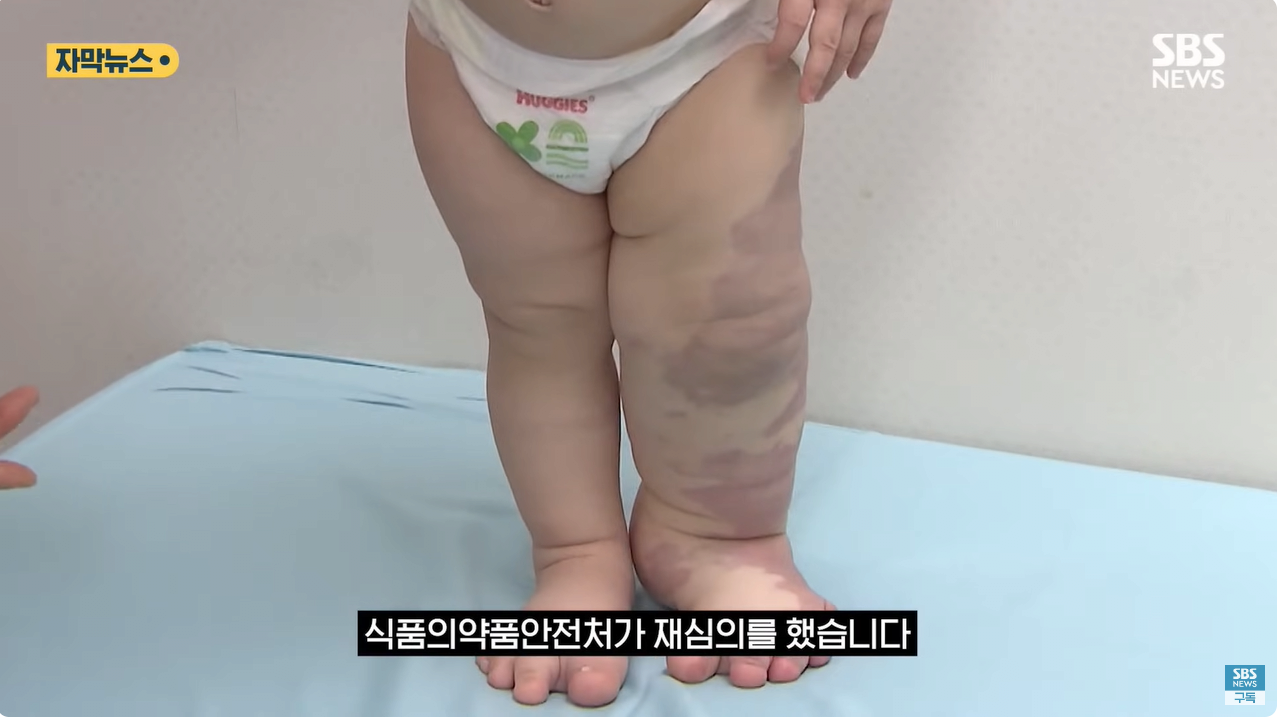 16.png "와 이건 가만히 못 있겠네" 의사와 부모가 기적을 썼다