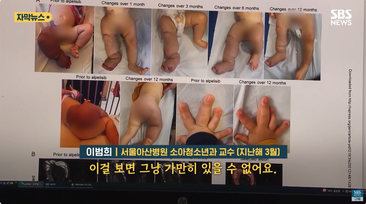 6.png "와 이건 가만히 못 있겠네" 의사와 부모가 기적을 썼다