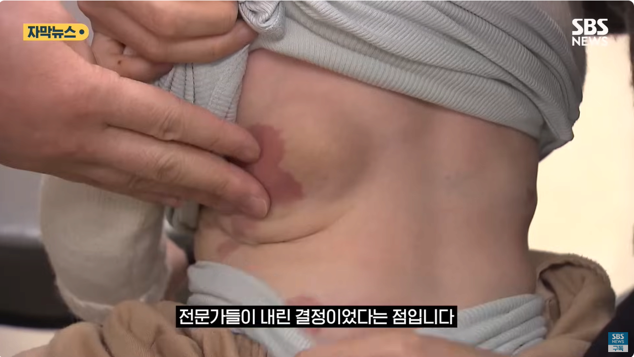 11.png "와 이건 가만히 못 있겠네" 의사와 부모가 기적을 썼다