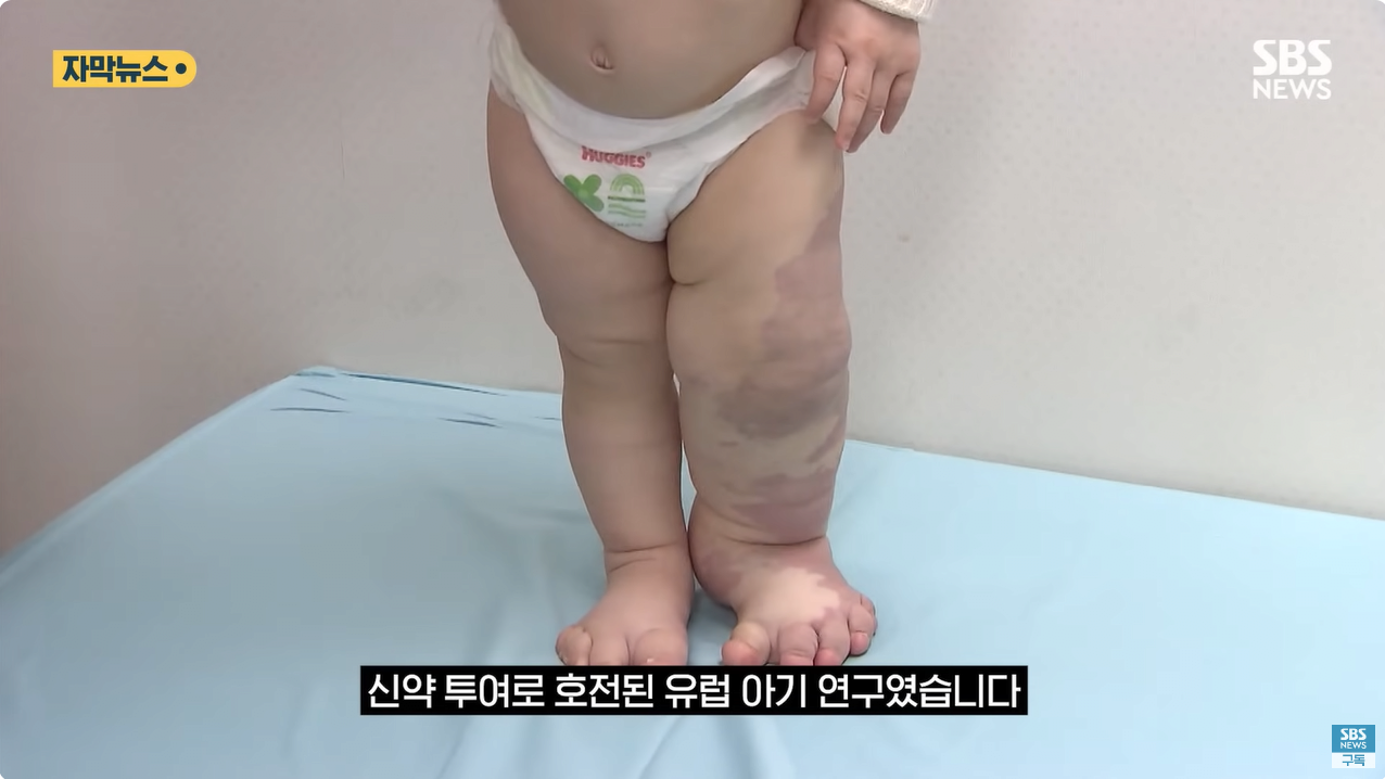 4.png "와 이건 가만히 못 있겠네" 의사와 부모가 기적을 썼다