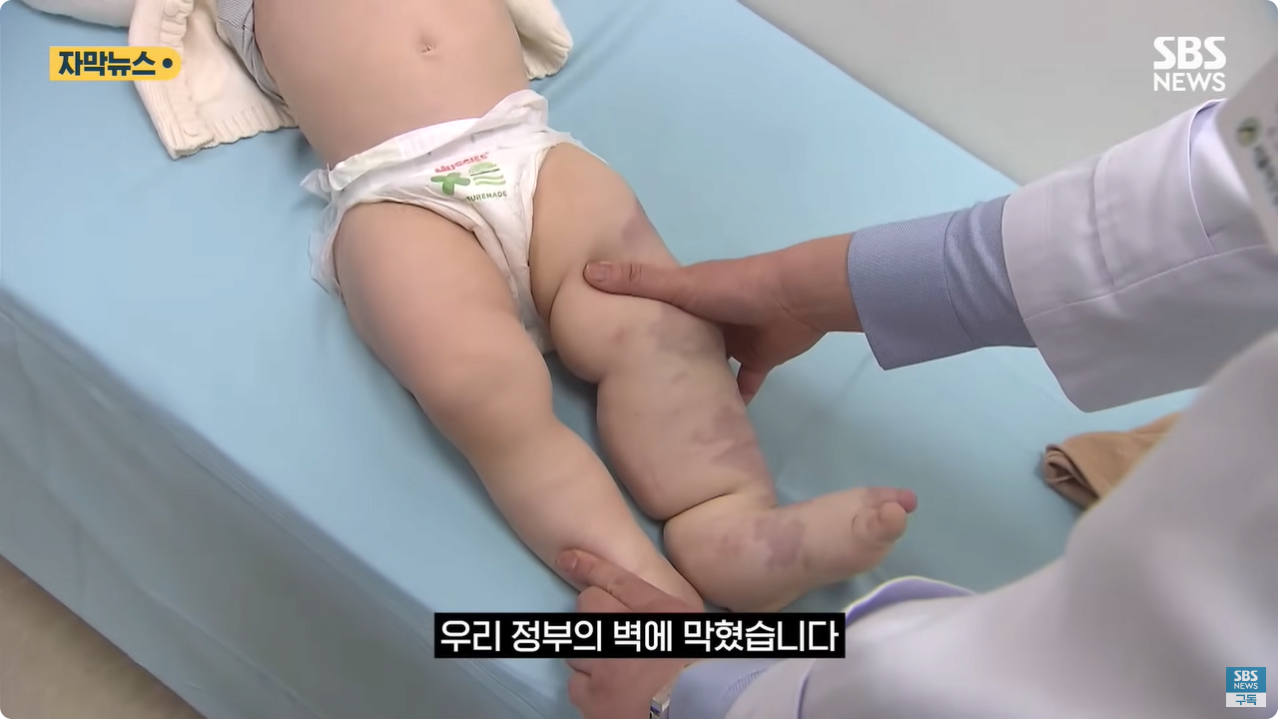 8.png "와 이건 가만히 못 있겠네" 의사와 부모가 기적을 썼다
