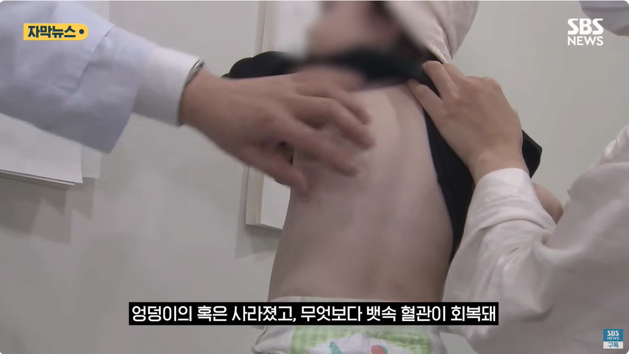 22.png "와 이건 가만히 못 있겠네" 의사와 부모가 기적을 썼다