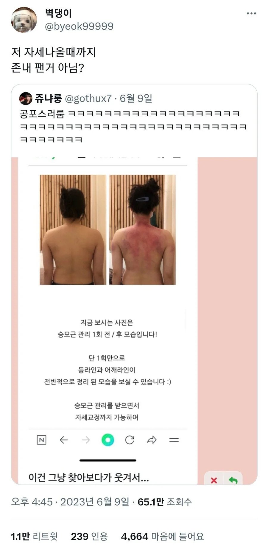 승모근.jpg