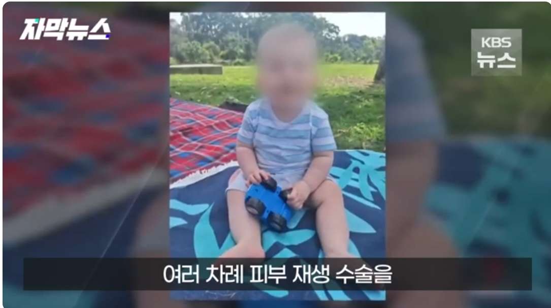 1.jpg 얼마전 호주에서 일어난 아기 커피 테러사건 근황