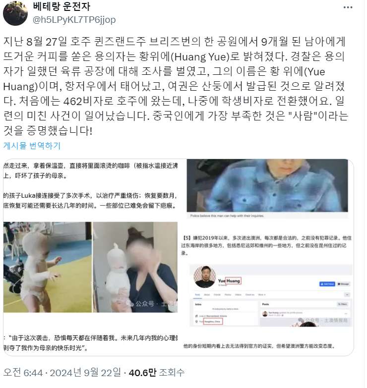 12.jpg 얼마전 호주에서 일어난 아기 커피 테러사건 근황