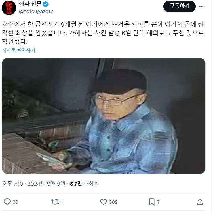 13.jpg 얼마전 호주에서 일어난 아기 커피 테러사건 근황