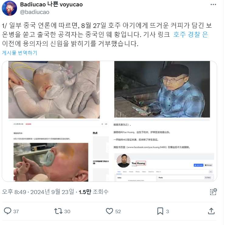 15.jpg 얼마전 호주에서 일어난 아기 커피 테러사건 근황