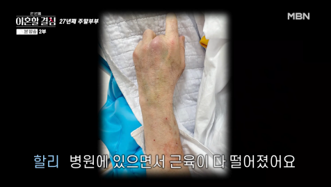 세계에서 0.1% 밖에 없다는 희귀암 걸렸던 연예인 | 인스티즈