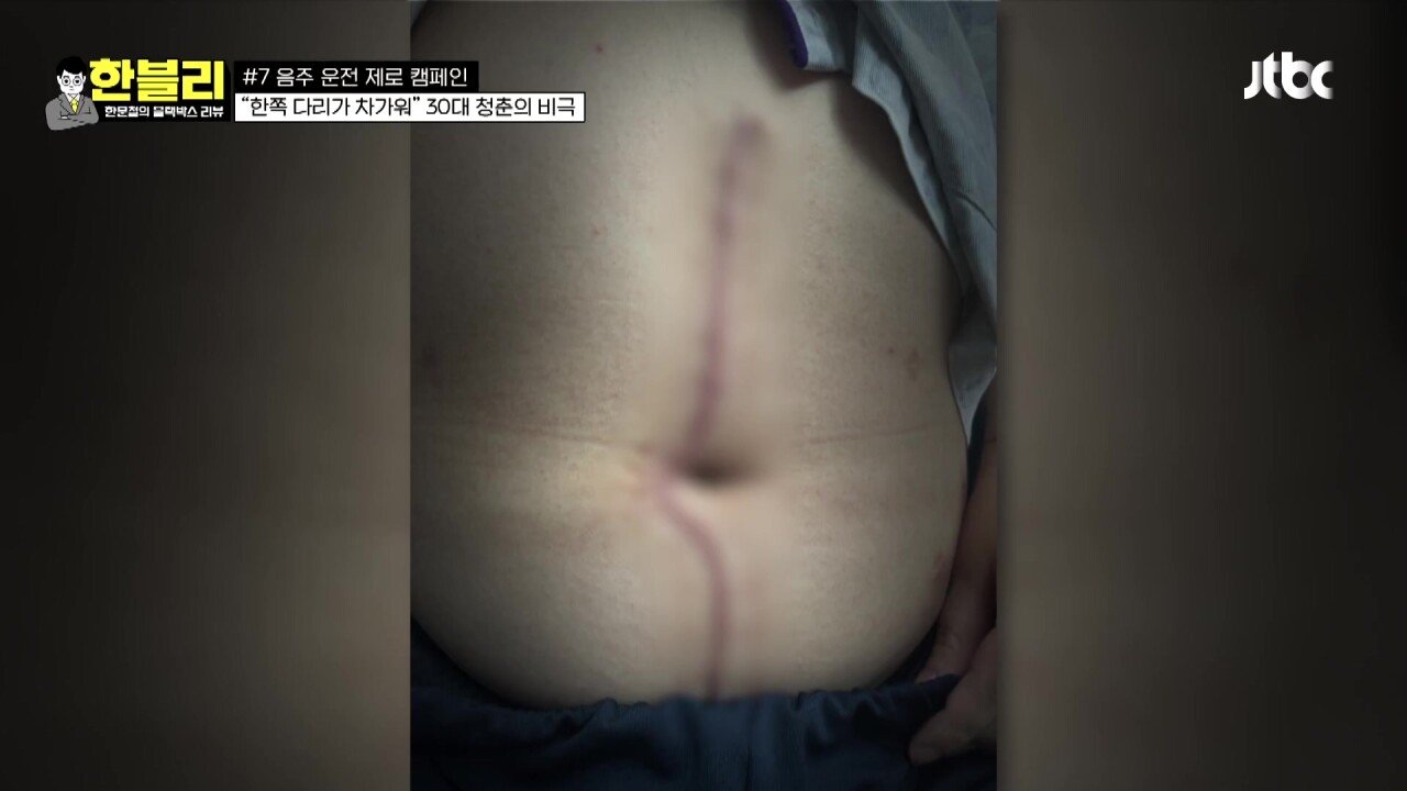한블리 1.mp4_20230907_222236.352.jpg 방금전 한문철블박리뷰에서다룬 30대의 청춘을 앗아간 음주운전 역주행차량